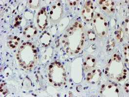 m01615 1 anti slug snai2 mouse monoclonal antibody clone id oti1a6 ihc testing 8