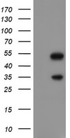 m01615 1 anti slug snai2 mouse monoclonal antibody clone id oti1a6 wb testing 1