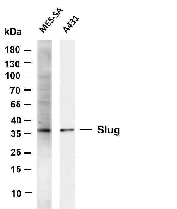Various whole cell lysates were separated by 4-20% SDS-PAGE, and the membrane was blotted with anti-Slug antibody