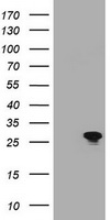 HEK293T cells were transfected with the pCMV6-ENTRY control (Left lane) or pCMV6-ENTRY BCL10 (Right lane) cDNA for 48 hrs and lysed