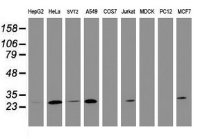 Western blot analysis of extracts (35ug) from 9 different cell lines by using anti-BCL10 monoclonal antibody (HepG2: human; HeLa: human; SVT2: mouse; A549: human; COS7: monkey; Jurkat: human; MDCK: canine; PC12: rat; MCF7: human)