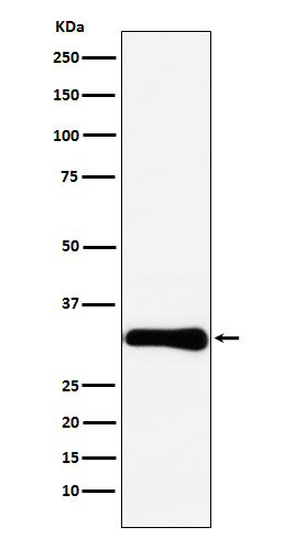Western blot analysis of Bcl10 expression in HeLa cell lysate