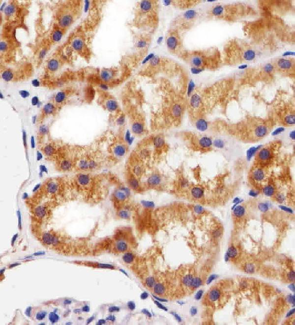 Immunohistochemical analysis of paraffin-embedded H
