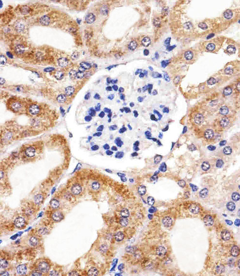 Immunohistochemical analysis of paraffin-embedded M