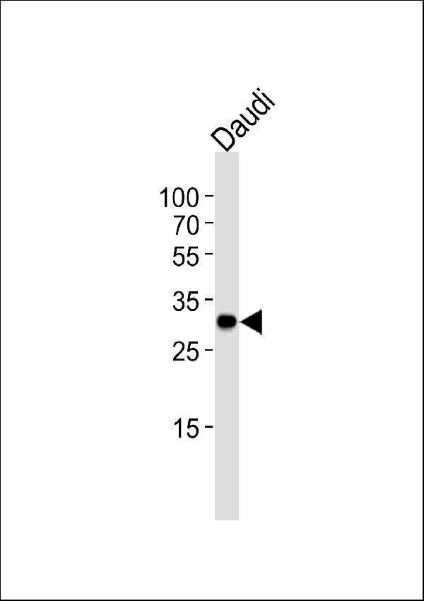 Western blot analysis of lysate from Daudi cell line using BCL10 Antibody