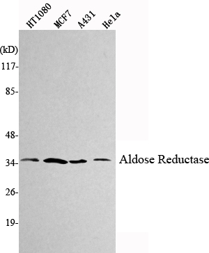 Western Blot analysis using Aldose Reductase Monoclonal Antibody against HT1080, MCF7, A431, HeLa cell lysate