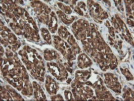 m01623 anti pgd mouse monoclonal antibody clone id oti2a5 ihc testing 4