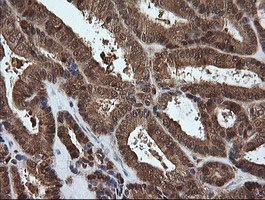 m01623 anti pgd mouse monoclonal antibody clone id oti2a5 ihc testing 5
