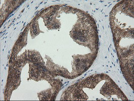 m01623 anti pgd mouse monoclonal antibody clone id oti2a5 ihc testing 6