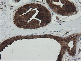 m01623 anti pgd mouse monoclonal antibody clone id oti2a5 ihc testing 7