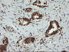 m01623 anti pgd mouse monoclonal antibody clone id oti2a5 ihc testing 8