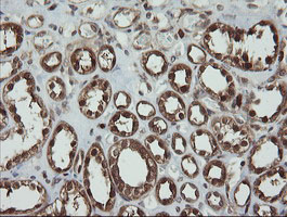 m01623 anti pgd mouse monoclonal antibody clone id oti2a5 ihc testing 9
