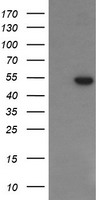 HEK293T cells were transfected with the pCMV6-ENTRY control (Left lane) or pCMV6-ENTRY PGD (Right lane) cDNA for 48 hrs and lysed