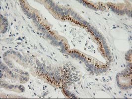 m01625 1 anti snap25 mouse monoclonal antibody clone id oti4b5 ihc testing 6