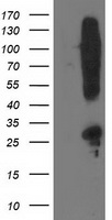 HEK293T cells were transfected with the pCMV6-ENTRY control (Left lane) or pCMV6-ENTRY SNAP25 (Right lane) cDNA for 48 hrs and lysed