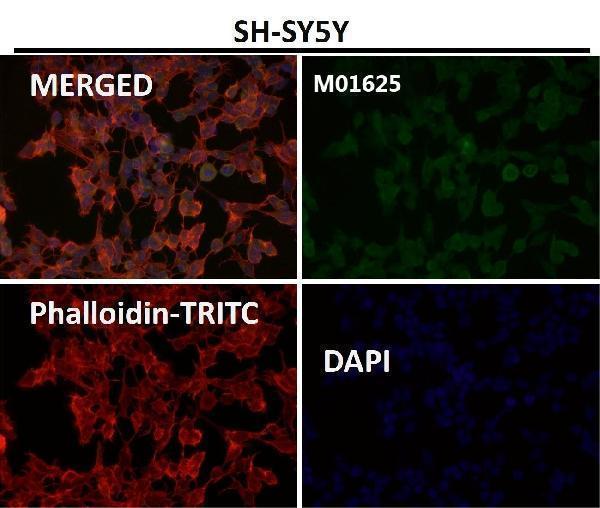 Immunofluorescent analysis using the Antibody at 1:50 dilution
