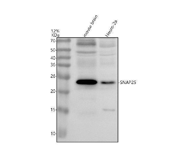 Western blot analysis of SNAP25 using anti-SNAP25 antibody (M01625)