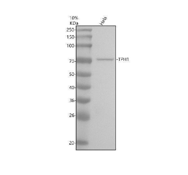 Western blot analysis of TPH1 using anti-TPH1 antibody (M01626)