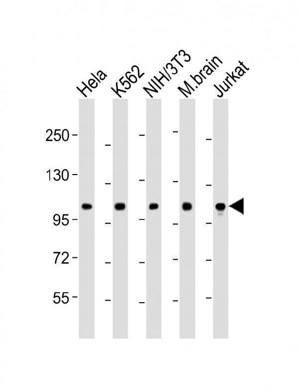 m01629 1 anti dnm2 antibody n term wb testing 2