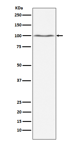 Western blot analysis of Dynamin 2 expression in Jurkat cell lysate