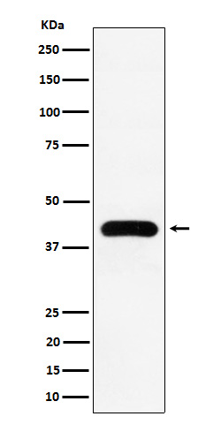 Western blot analysis of MVD expression in K562 cell lysate