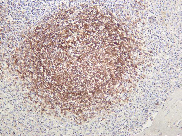 Human spleen was stained with anti-CD21 rabbit antibody