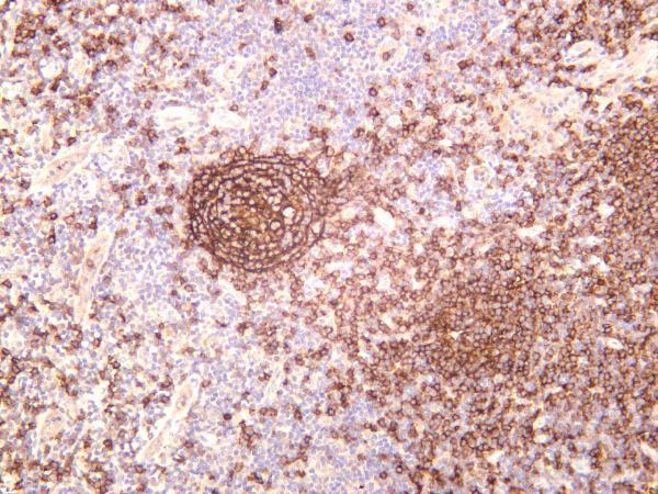 Human tonsil was stained with anti-CD21 rabbit antibody