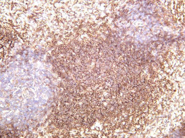 m01632 2 cr2 primary antibodies ihc testing 4