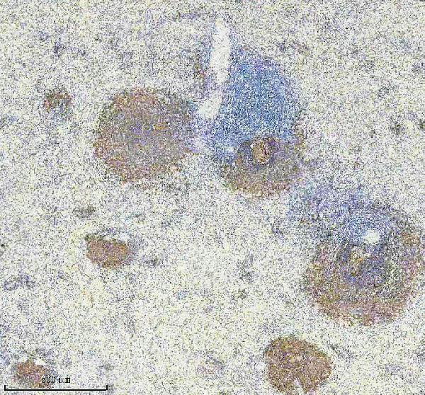 IHC analysis of CD21 using anti-CD21 antibody (M01632-3)