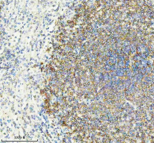 IHC analysis of CD21 using anti-CD21 antibody (M01632-3)
