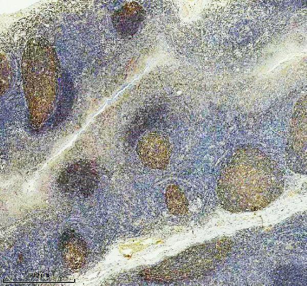 IHC analysis of CD21 using anti-CD21 antibody (M01632-3)