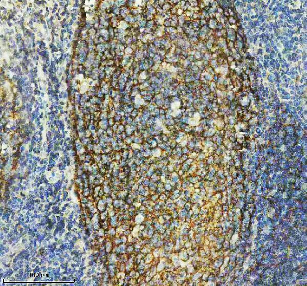 m01632 3 cd21 primary antibodies ihc testing 4