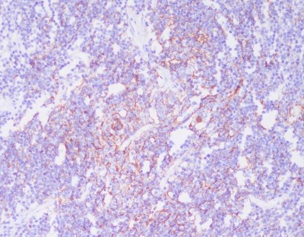 Immunohistochemical analysis of paraffin-embedded human spleen, using CD21 Antibody