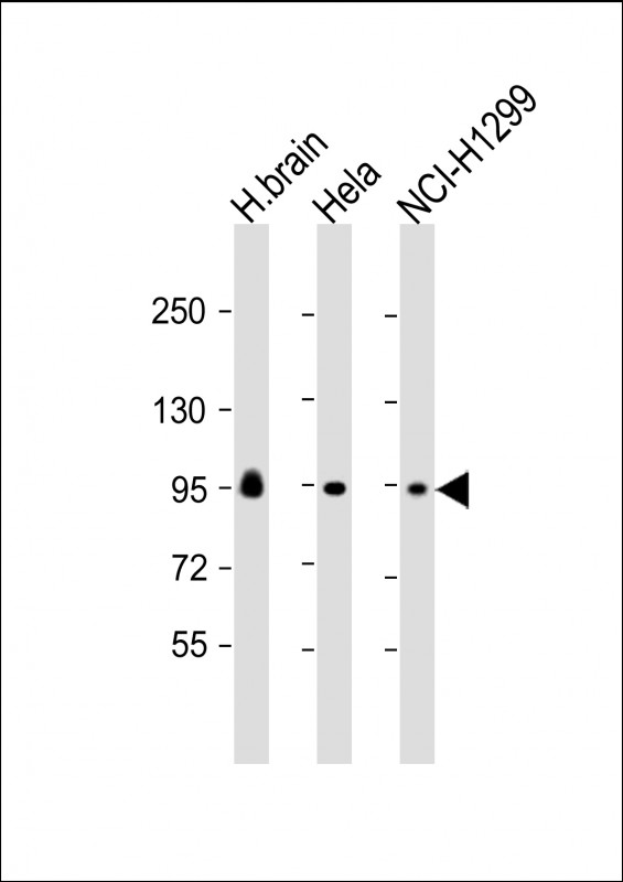 m01634 anti galc antibody n term wb testing 1