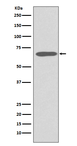 Western blot analysis of Cytokeratin 1 expression in Human skin lysate