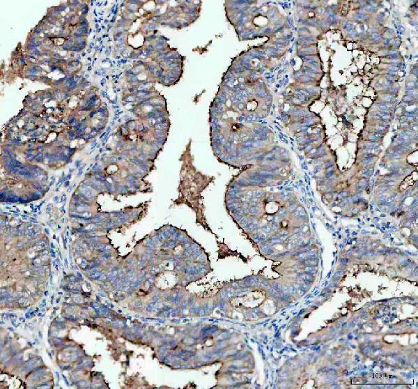 m01641 1 muc16 primary antibodies ihc testing 1