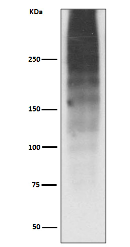 Western blot analysis of MUC16 expression in Human ovary cancer lysate