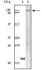 Western Blot analysis using Tyk 2 Monoclonal Antibody against truncated TYK2 recombinant protein (1) and Jurkat cell lysate (2)
