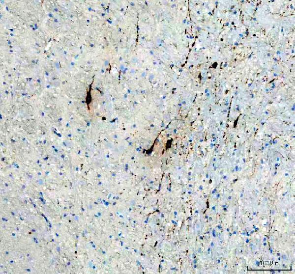 m01643 tph2 primary antibodies ihc testing 1