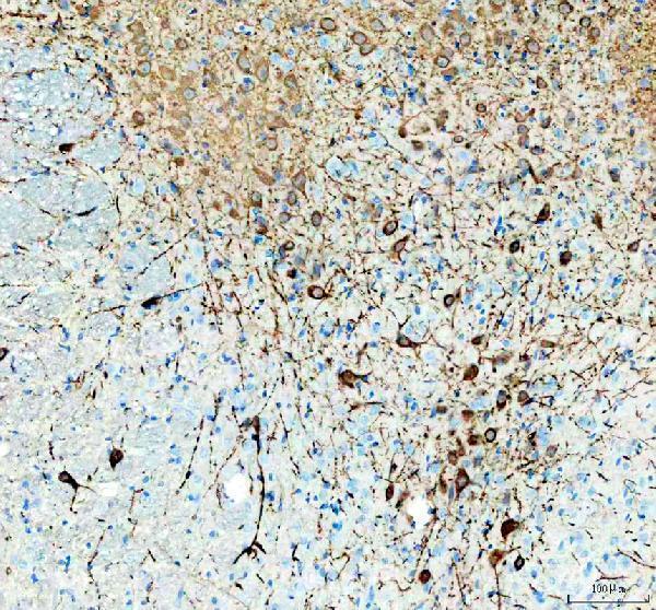 m01643 tph2 primary antibodies ihc testing 2