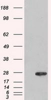 m01645 anti adenylate kinase 1 ak1 mouse monoclonal antibody clone id oti8a1 wb testing 1