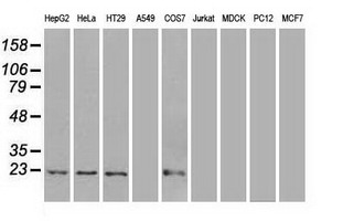 m01645 anti adenylate kinase 1 ak1 mouse monoclonal antibody clone id oti8a1 wb testing 2