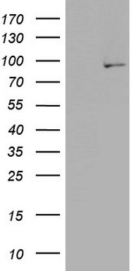 HEK293T cells were transfected with the pCMV6-ENTRY control (Left lane) or pCMV6-ENTRY PLA2G6 (Right lane) cDNA for 48 hrs and lysed