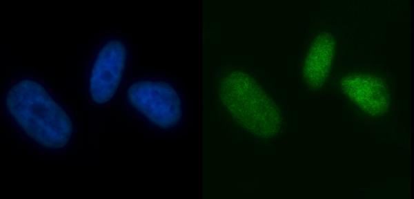 m01649 3 mcm7 primary antibodies if testing 6