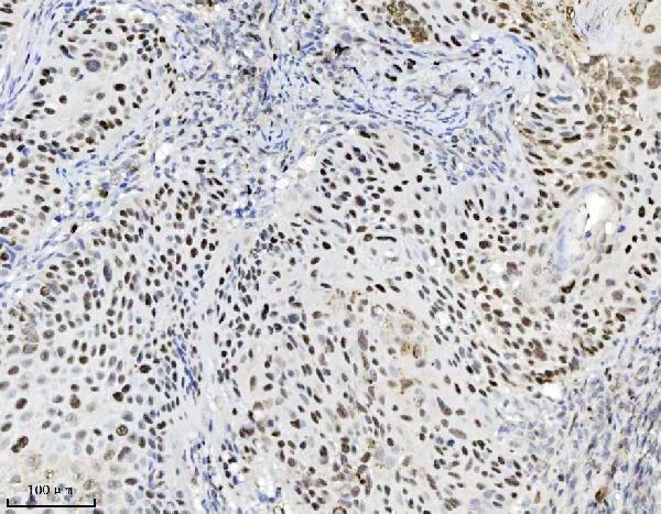  IHC analysis of MCM7 using anti-MCM7 antibody (M01649-3)