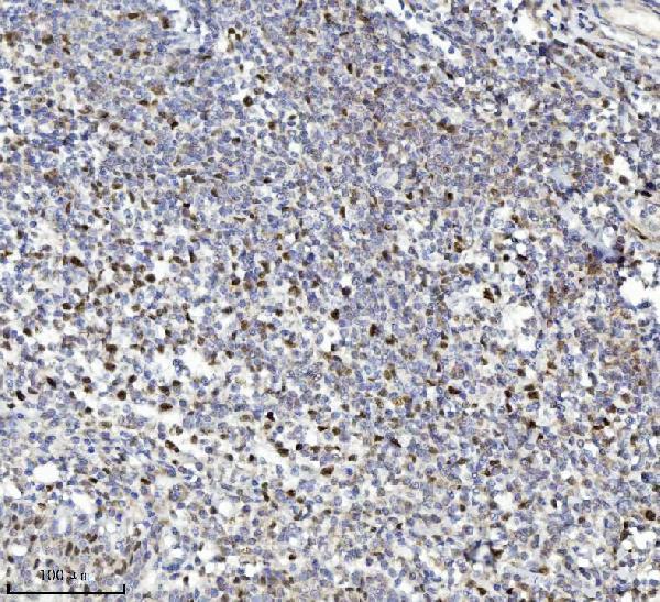 m01649 3 mcm7 primary antibodies ihc testing 5