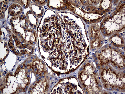 m01650 anti carboxypeptidase m cpm mouse monoclonal antibody clone id oti4e11 ihc testing 10