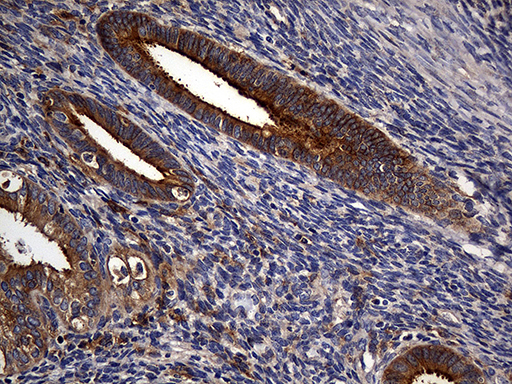 m01650 anti carboxypeptidase m cpm mouse monoclonal antibody clone id oti4e11 ihc testing 4
