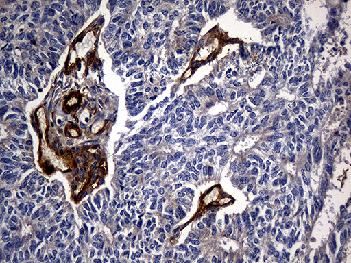 m01650 anti carboxypeptidase m cpm mouse monoclonal antibody clone id oti4e11 ihc testing 5