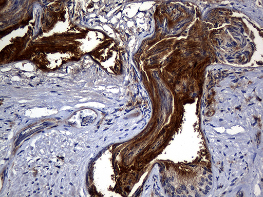m01650 anti carboxypeptidase m cpm mouse monoclonal antibody clone id oti4e11 ihc testing 6